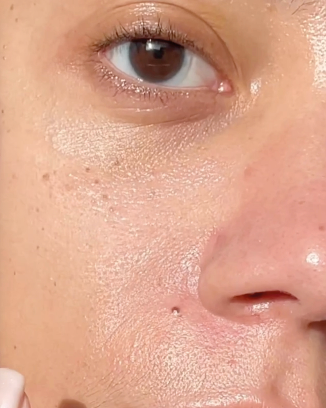 Close-up of a person's eye with a focus on skin texture.